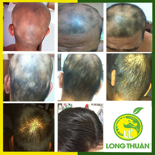 effect-hair-growth-fast-essential-oil-pomelo-flower-long-thuan